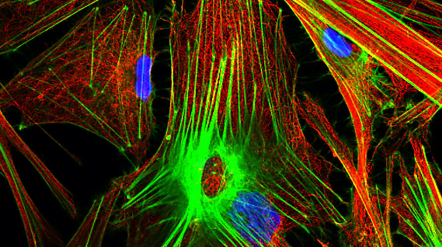 image of MT Actin